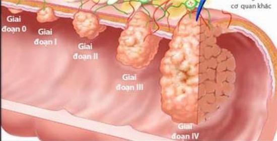 Bác sĩ khoa Tiêu hóa