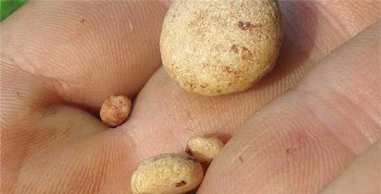 Bài thuốc chữa sỏi thận