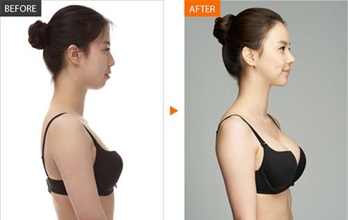 tang size vong 1 nho loai qua ngon, bo, re ma o dau cung co - 5