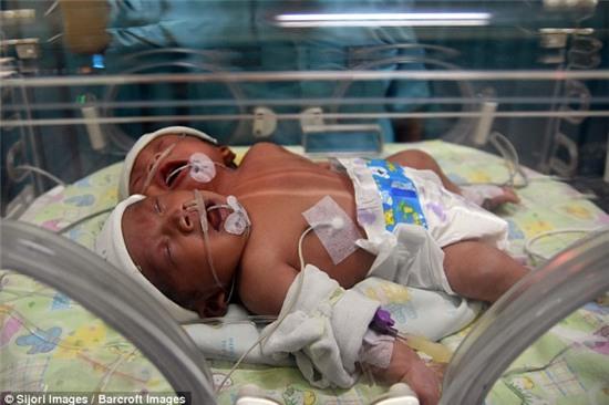 be gai hai dau chao doi tai indonesia hinh anh 1