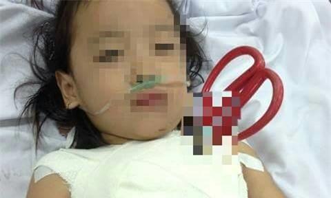 Be gai 5 tuoi bi keo cat dam xuyen nguc hinh anh 1