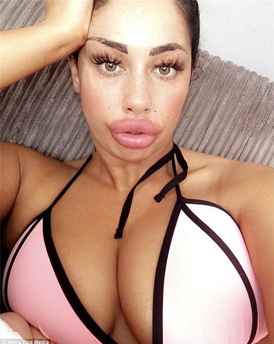 Bà mẹ đơn thân nghiện bơm môi theo phong cách... cá dọn bể - Ảnh 2.