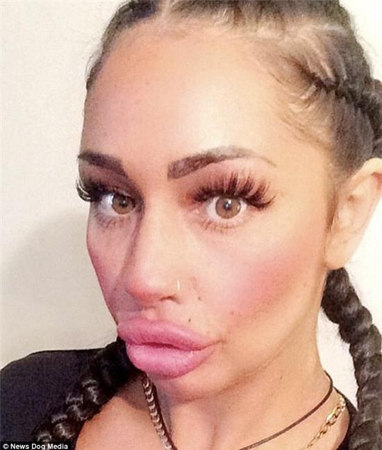 Bà mẹ đơn thân nghiện bơm môi theo phong cách... cá dọn bể - Ảnh 3.