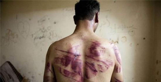 Lời kể kinh hoàng của những người bước ra từ nhà tù Syria