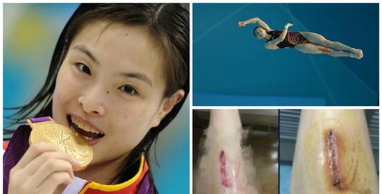 Góc khuất day dứt phía sau kỷ lục Olympic của