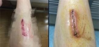 Góc khuất day dứt phía sau kỷ lục Olympic của Nữ thần TQ - Ảnh 3.