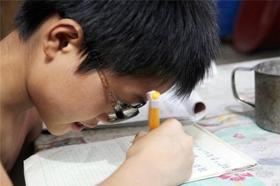 Cậu bé mới 11 tuổi đã phải đeo cặp đít chai dày cộp hơn 2.000 độ cận thị - Ảnh 3.