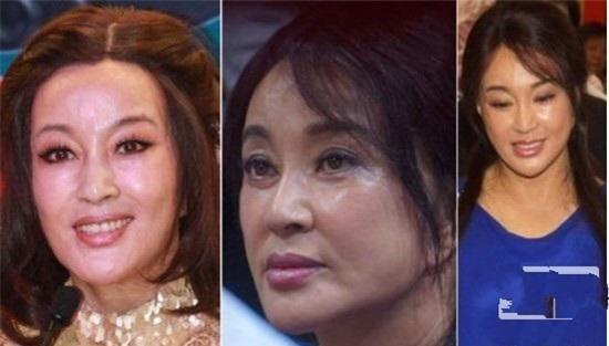 Những mỹ nhân châu Á đang phải trả giá đắt vì chạy theo phẫu thuật thẩm mỹ - Ảnh 24.