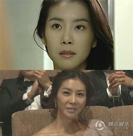 Những mỹ nhân châu Á đang phải trả giá đắt vì chạy theo phẫu thuật thẩm mỹ - Ảnh 6.