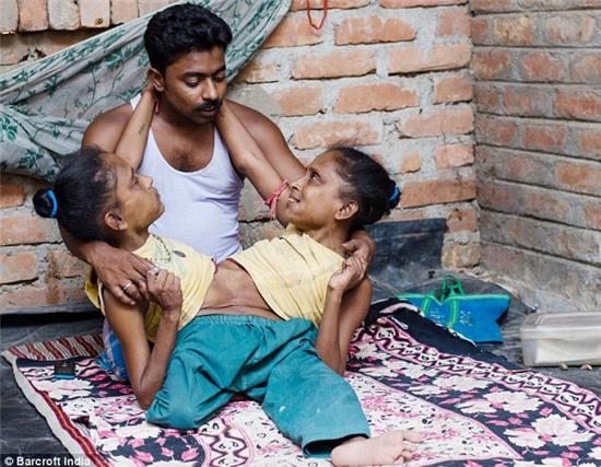 Hai chị em sinh đôi dính liền 47 tuổi tìm thấy tình yêu đích thực bên phi công trẻ - Ảnh 1.