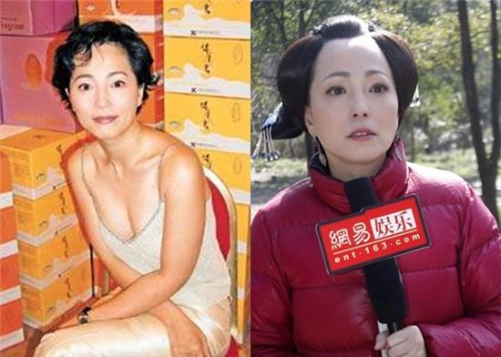 Sao nu xau nhat cua Chau Tinh Tri tung phai di vien tam than hinh anh 3