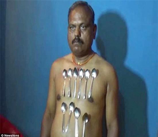 Những chiếc thìa kim loại dính trên ngực và bụng của ông Raikar