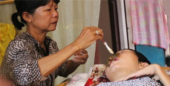 Cô gái bị bệnh lạ