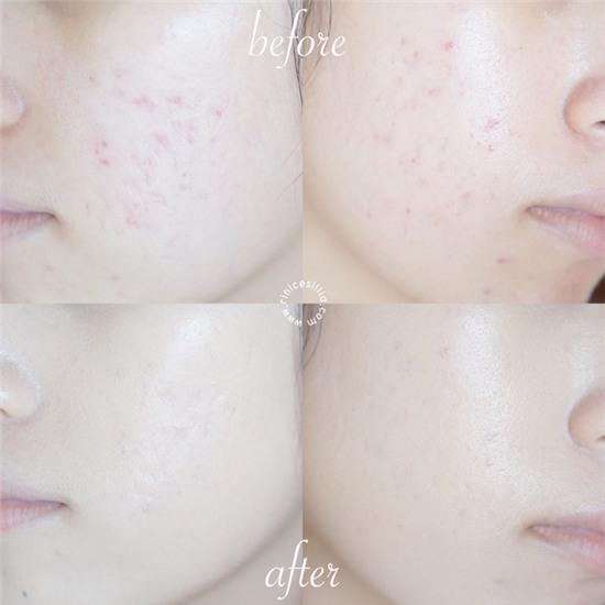 6 món mỹ phẩm đang được con gái Việt thi nhau mua thời gian này - Ảnh 4.