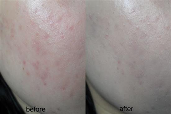 6 món mỹ phẩm đang được con gái Việt thi nhau mua thời gian này - Ảnh 8.