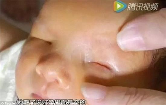 Bé sơ sinh chào đời với khuôn mặt... không có mắt - Ảnh 1.
