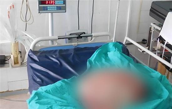 Người phụ nữ mang thai khối u nặng tới 31kg nhiều năm liền trong bụng - Ảnh 2.