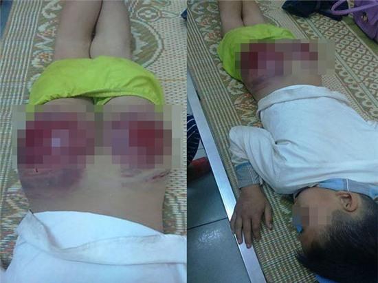 Bố đánh con tứa máu ở Thái Nguyên: Tôi cũng thương lắm, nhưng... - Ảnh 1.