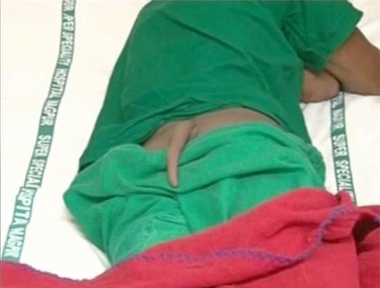 Kì lạ thanh niên 18 tuổi mọc đuôi sau lưng