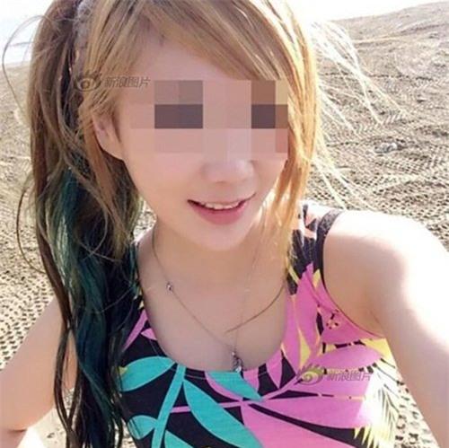 Mẫu nội y chết thảm vì bạn trai bỏ mặc khi sốc thuốc - 1