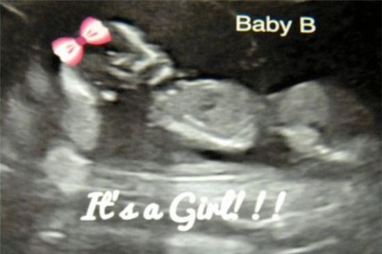 chang trai co 100 con vi cho khong tinh trung tren mang hinh anh 3