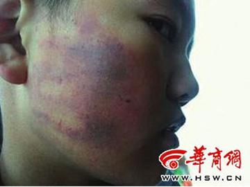 Phẫn nộ vì cô giáo bắt 50 học sinh  thay nhau tát bạn