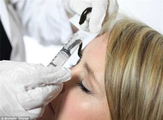 Rùng rợn liệu pháp trị bệnh dùng đỉa hút máu 2