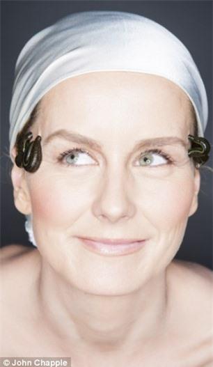 Rùng rợn liệu pháp trị bệnh dùng đỉa hút máu 3