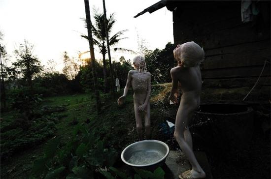 Bộ ảnh độc về thế giới của cặp song sinh bạch tạng ở Hà Tĩnh 9