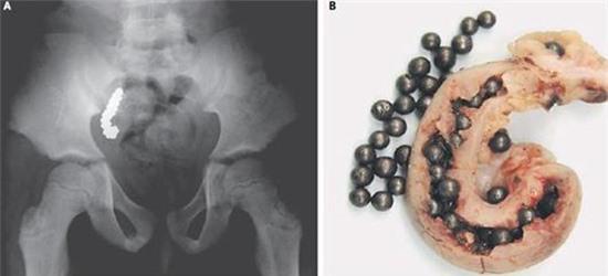 Những bức ảnh X-quang cơ thể shock chưa từng thấy 1