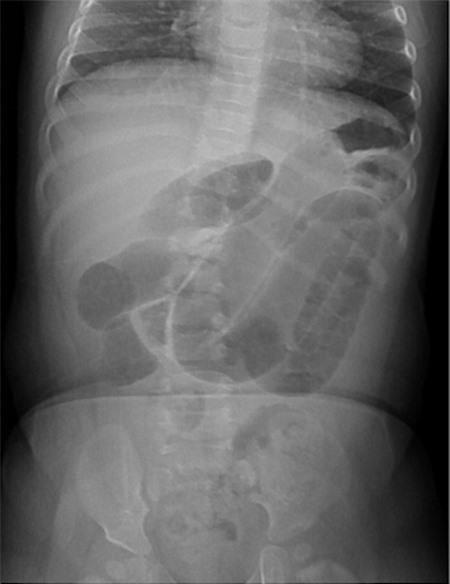 Những bức ảnh X-quang cơ thể shock chưa từng thấy 4