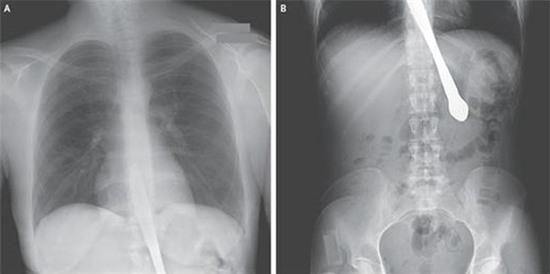 Những bức ảnh X-quang cơ thể shock chưa từng thấy 5