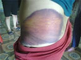 Chuyện tình đẫm nước mắt của người vợ mù bị chồng đánh sau khi ép 'quan hệ' | Bạo hành, Người mù, Vợ chồng, Đánh nhau, Quan hệ tình dục, Ghen tuông