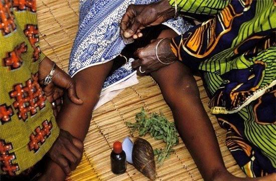 Vô nhân đạo với hủ tục cắt vùng kín, là ngực, thiêu sống phụ nữ | Chuyện lạ 4 phương,Chuyện lạ thế giới,Phi thường,Chuyện lạ có thật,Chuyện lạ khó tin