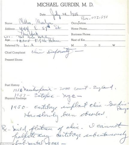 Những bằng chứng về việc Marilyn Monroe đã phẫu thuật thẩm mỹ.