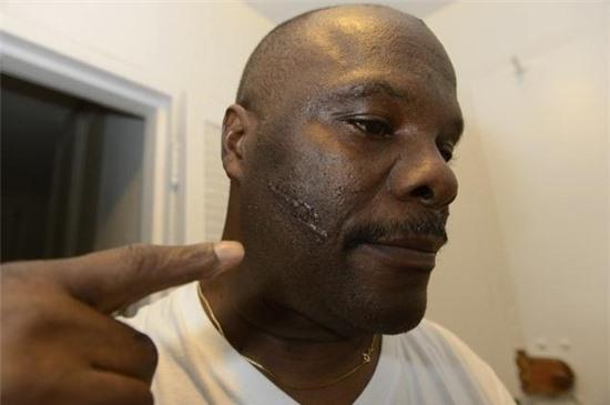 Bị thương do bồn cầu phát nổ khi... giật nước 3