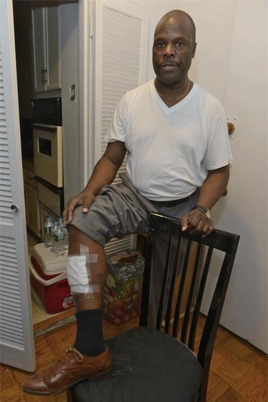 Bị thương do bồn cầu phát nổ khi... giật nước 5