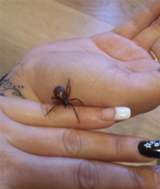 Kinh hãi giòi tấn công não vì nối tóc 2