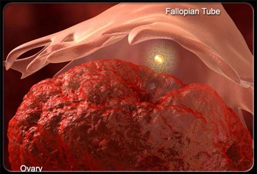 Điểm mặt tất cả nguyên nhân khiến bạn bị đau vùng xương chậu 3