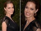 Sốc với hình ảnh gầy hốc hác của Angelina Jolie