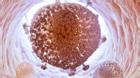 'Xóa sổ' thành công virus HIV khỏi tế bào con người?