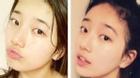 Suzy (Miss A) được minh oan chuyện phẫu thuật thẩm mỹ khuôn mặt