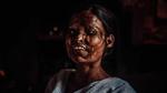 Ký ức kinh hoàng của những cô gái bị tạt axit ở Ấn Độ
