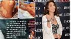 Ảnh bỏng nặng toàn thân của diễn viên xinh đẹp Đài Loan gây sốc