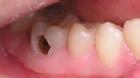 9 bệnh về răng mọi người hay mắc