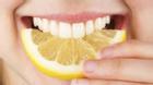 3 thực phẩm giúp loại bỏ cao răng siêu hiệu quả ngay tại nhà