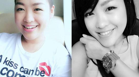 Nghị lực của cô gái bị ung thư, phải cắt nửa buồng trứng