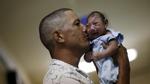 Chùm ảnh: Gương mặt đáng thương của những đứa trẻ bị nhiễm virus gây teo não Zika