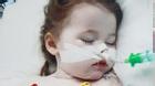 Bé gái 2 tuổi nuốt pin gây cháy phổi