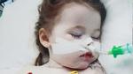 Bé gái 2 tuổi nuốt pin gây cháy phổi